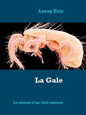 cover image of La Gale